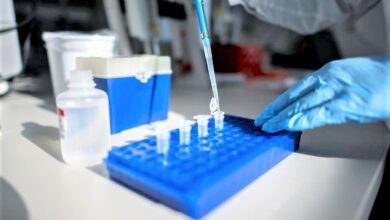 koronavirus laboratorija analize madjarska 1