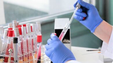 koronavirus covid 19 epidemija belgija laboratorija testovi analize 2
