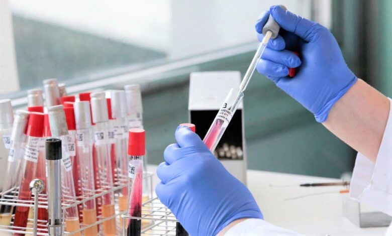 koronavirus covid 19 epidemija belgija laboratorija testovi analize 2