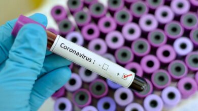 2020 02 24 coronavirus en