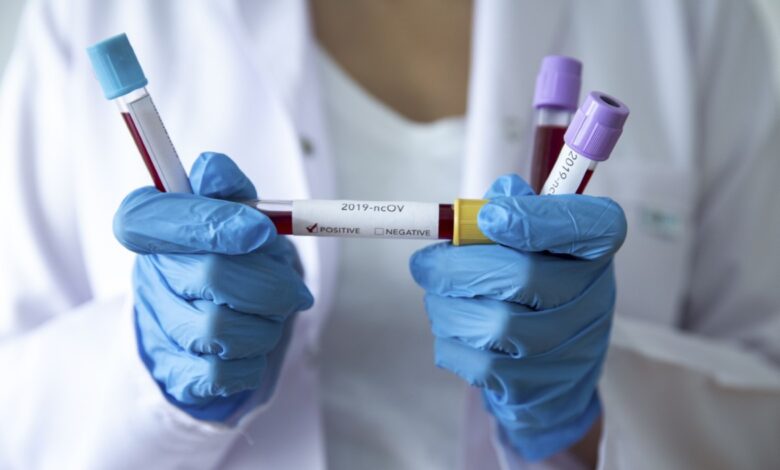 Koronavirus laboratorija uzorci krvi 3