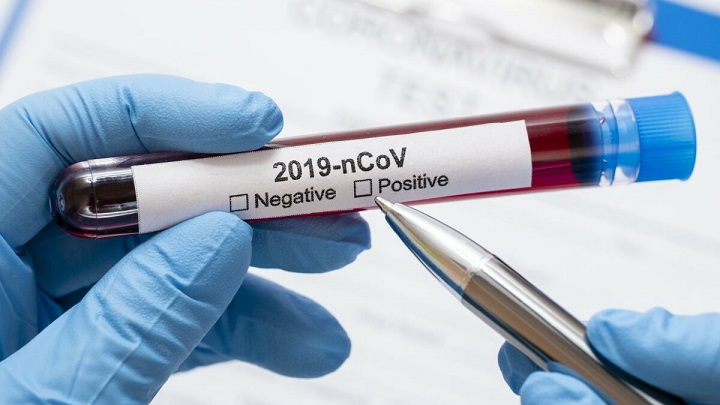 Koronavirus nalaz 1 1200x675 1