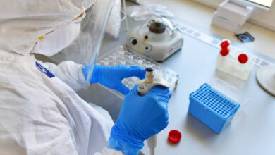 korona virus laboratorija testovi srbija nis 13