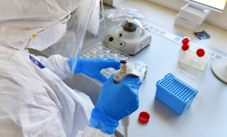 korona virus laboratorija testovi srbija nis 13