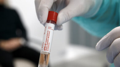 koronavirus covid 19 epidemija svajcarska zeneva testovi laboratorija analiize