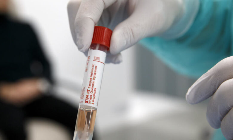 koronavirus covid 19 epidemija svajcarska zeneva testovi laboratorija analiize