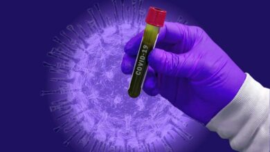 virus covid 19 korona PIXABAY