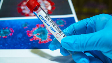 kovid 19 test korona virus 11