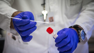 korona virus kovid 19 testovi testiranje italija 44