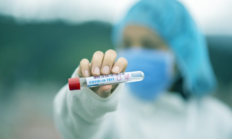 test tube 5065425 1280