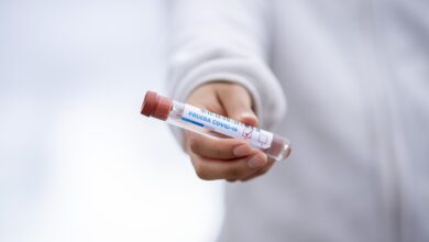 test tube 5065426 1280
