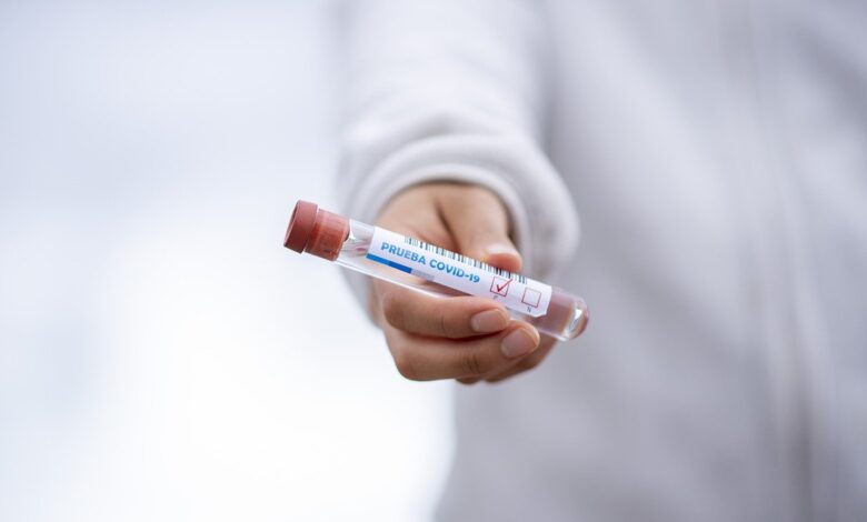 test tube 5065426 1280